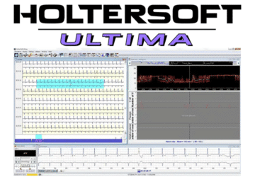 2-HolterSoft-ultima-affichage-logiciel_cpap-store.fr_.png